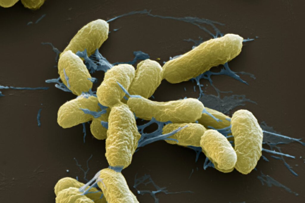 Pneumonic Plague Infections in Modern Times Show the Black Death Isn’t Dead