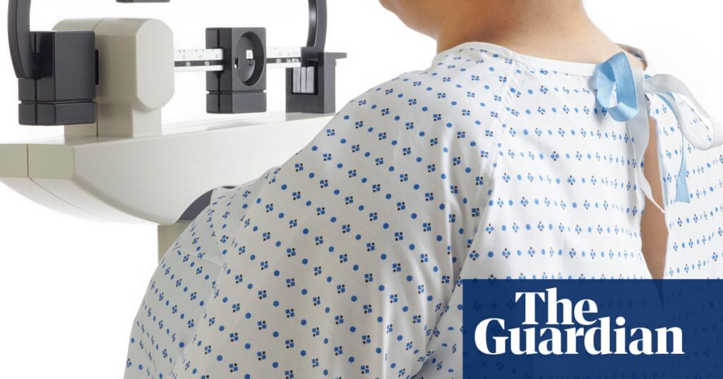 UK’s obesity and overweight epidemic costs £126bn a year, study suggests | Obesity